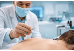 Usos habituales de las agujas de acupuntura en entornos profesionales